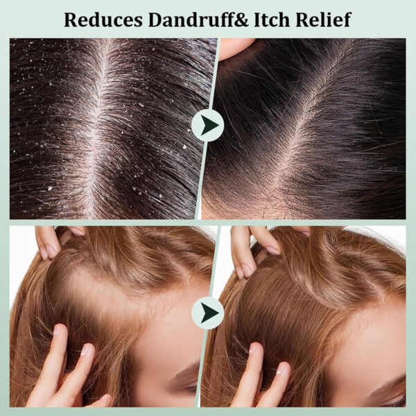 Private Label Anti Dandruff Rosemary Mint Scalp Scrub - Image 4