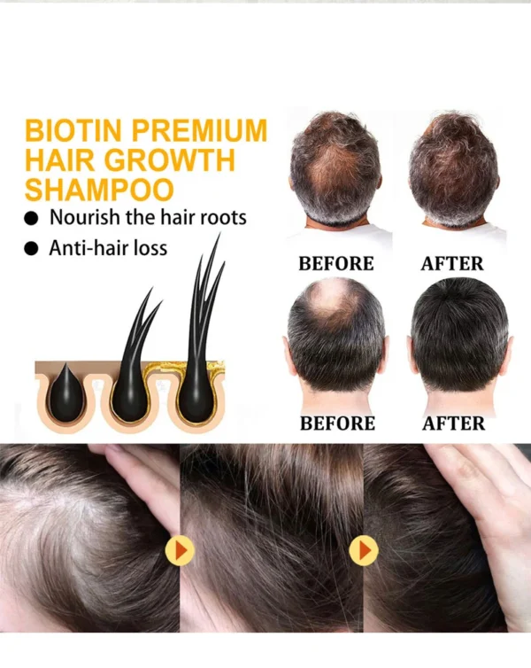 OEM/ODM Biotin Hair Growth Shampoo Set - Image 5