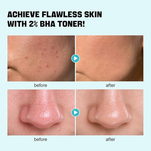 2% Salicylic acid+nicatinamide Toner - Image 5
