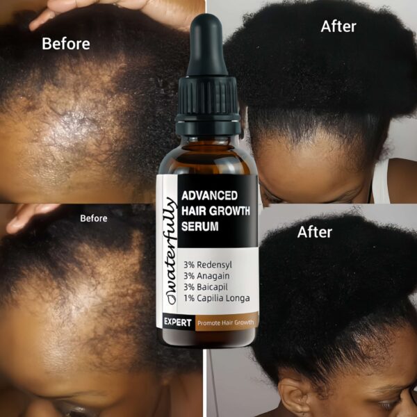 3% Redensyl+3% Anagain+3% Baicapil Hair Gorwth Serum