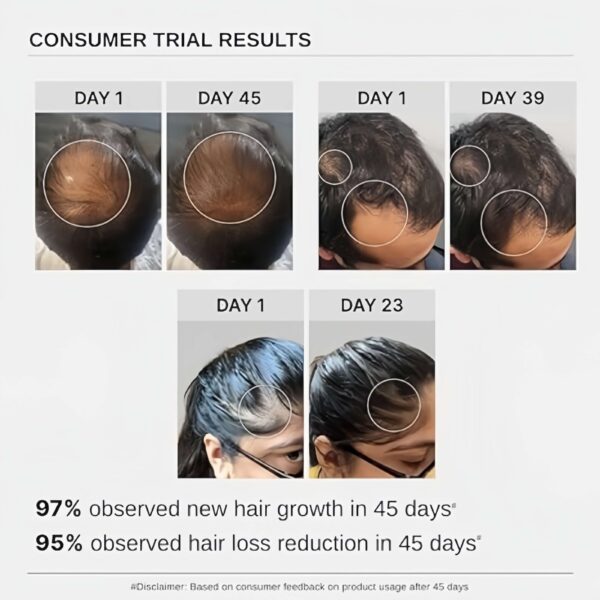 3% Redensyl+3% Anagain+3% Baicapil Hair Gorwth Serum - Image 3
