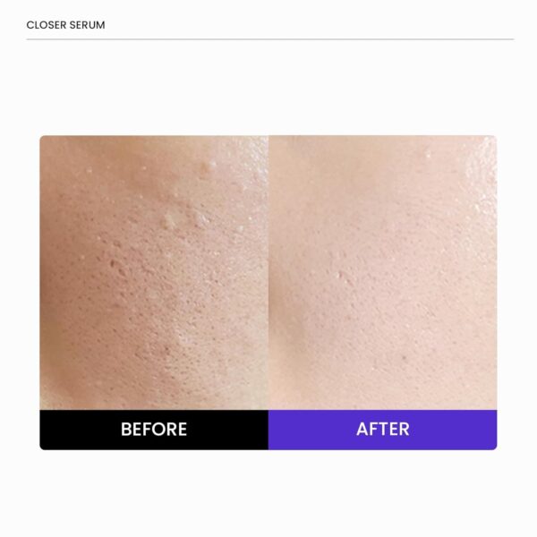 OEM/ODM Closer Pore Minimizing Serum - Image 4