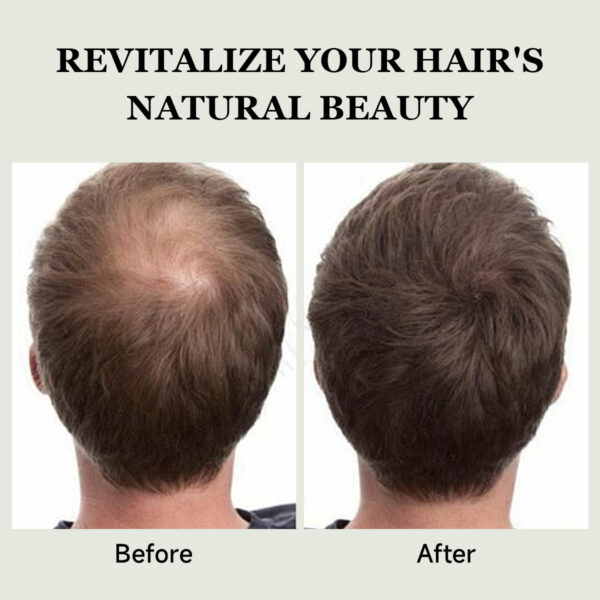 3% Redensyl+3% Anagain+3% Baicapil Hair Gorwth Shampoo Set - Image 5