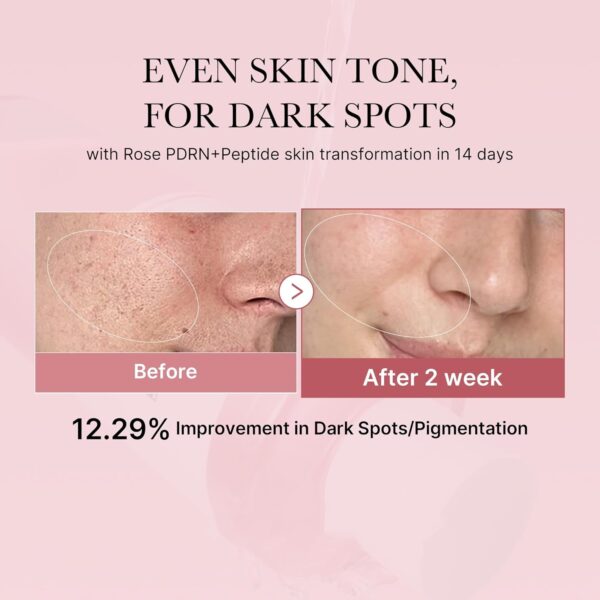 PDRN Pink Peptide Toner Improvement in Dark Spots/Pigmentation - Image 4