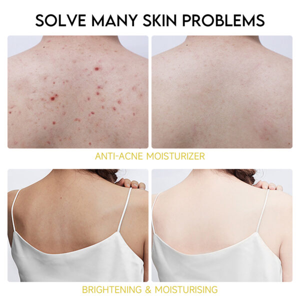 Turmeric Kojic Acid Body Lotion - Image 5