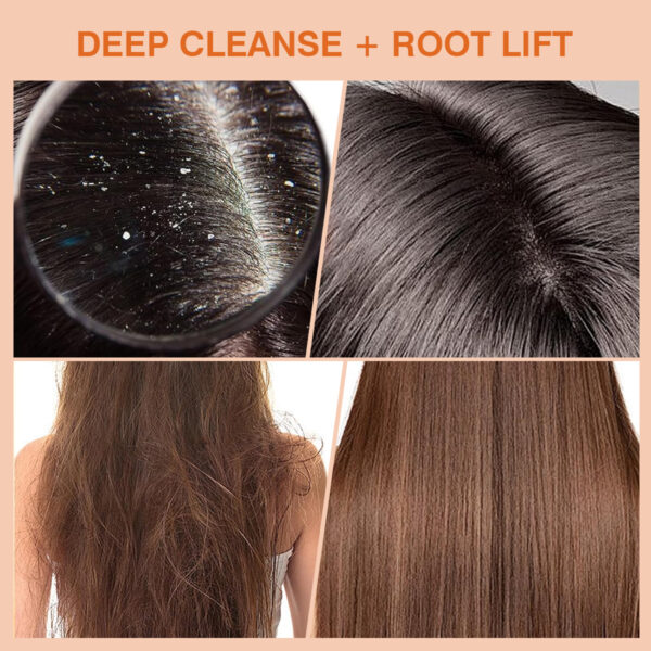 OEM/ODM Banana Hair Treatment Scalp Scrub​​ Shampoo - Image 5