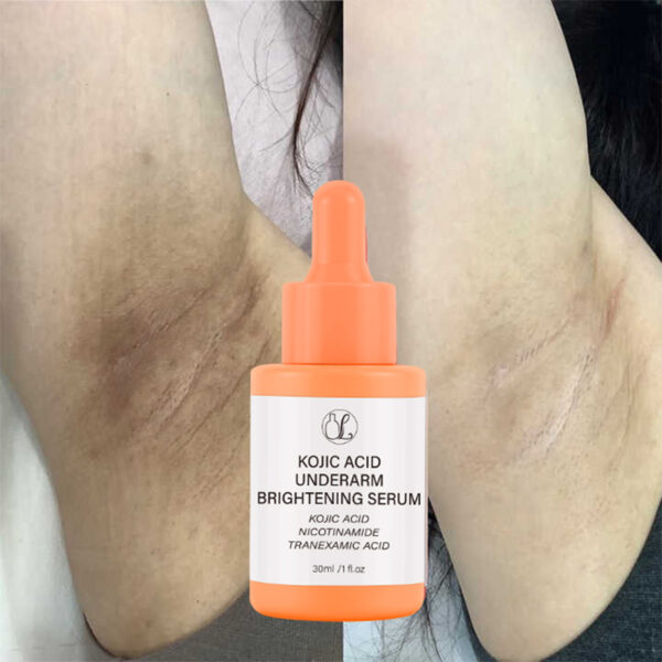 Kojic Acid Underarm whitening Serum