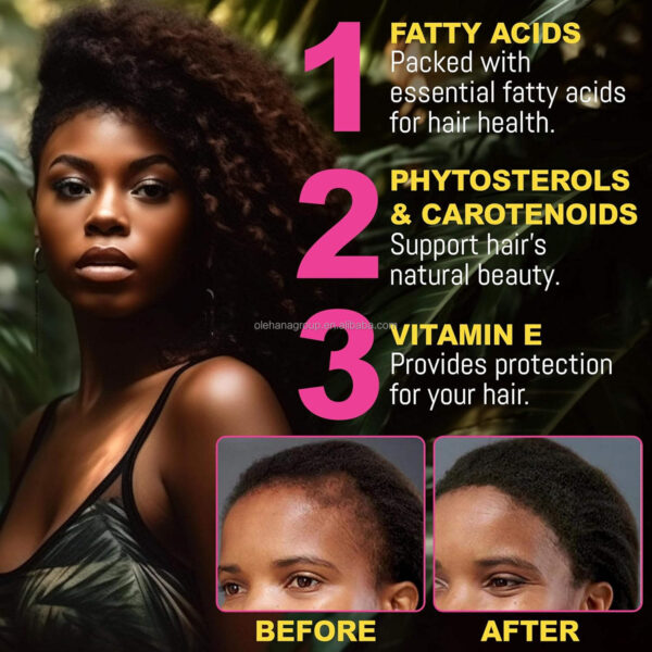 Wholesale 100% Pure Batana Oil Hair Growth Oil - Image 3