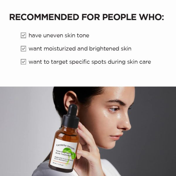 Oem/Odm Korea Skincare Centella Asiatica Ance Treatment Serum - Image 3