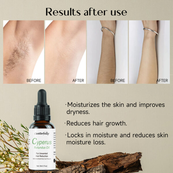 cyperus rotundus oil cyperus oil hair removal - Image 4