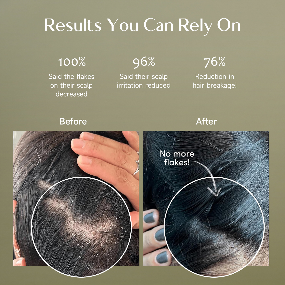 Butter Anti-Dandruff Shampoo | 100% Dandruff Reduction & Scalp Soothing - Image 5