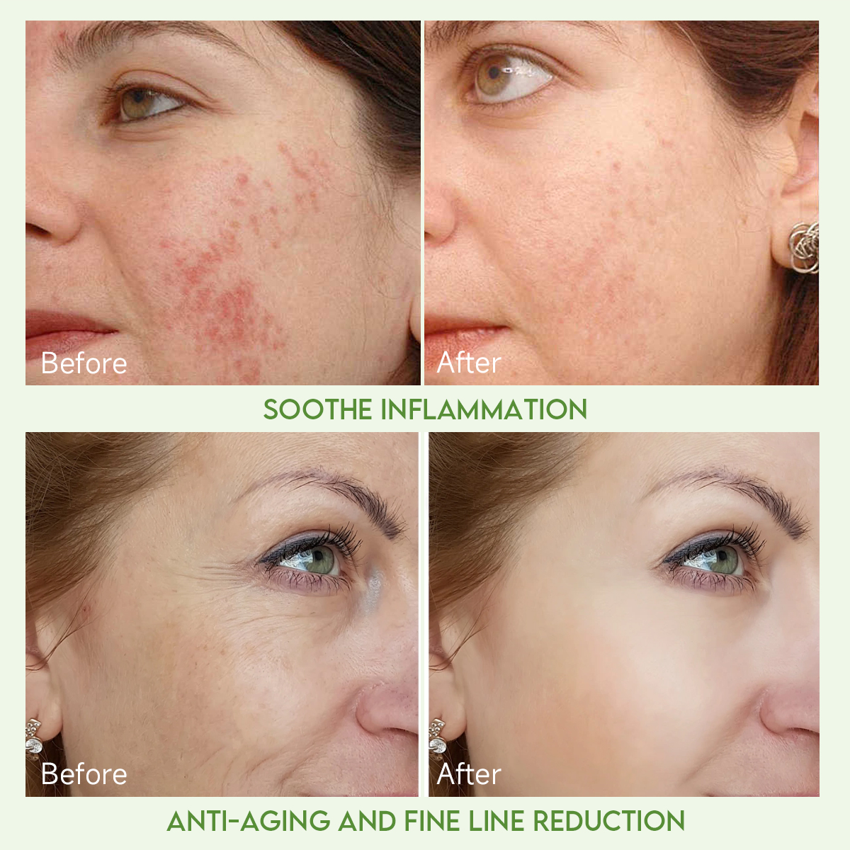 Amla Skincare Set | Anti-Aging · Brightening · Barrier Repair - Image 3