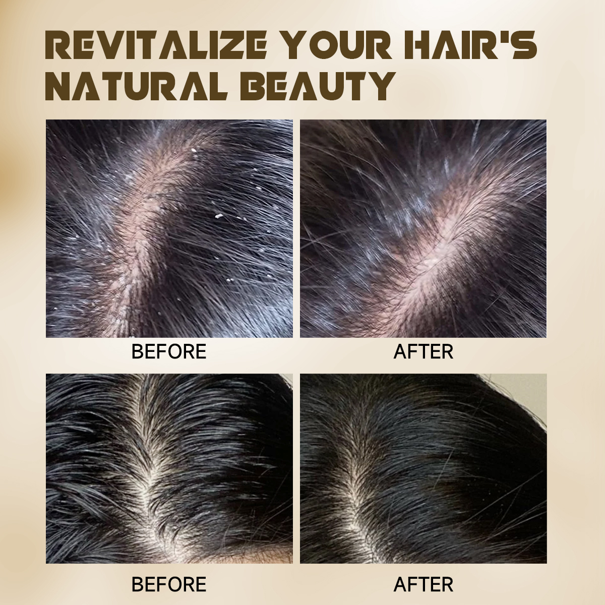 Oil-Control Hair Care Set | Volume Boost · Scalp Balance · Anti-Dandruff - Image 2