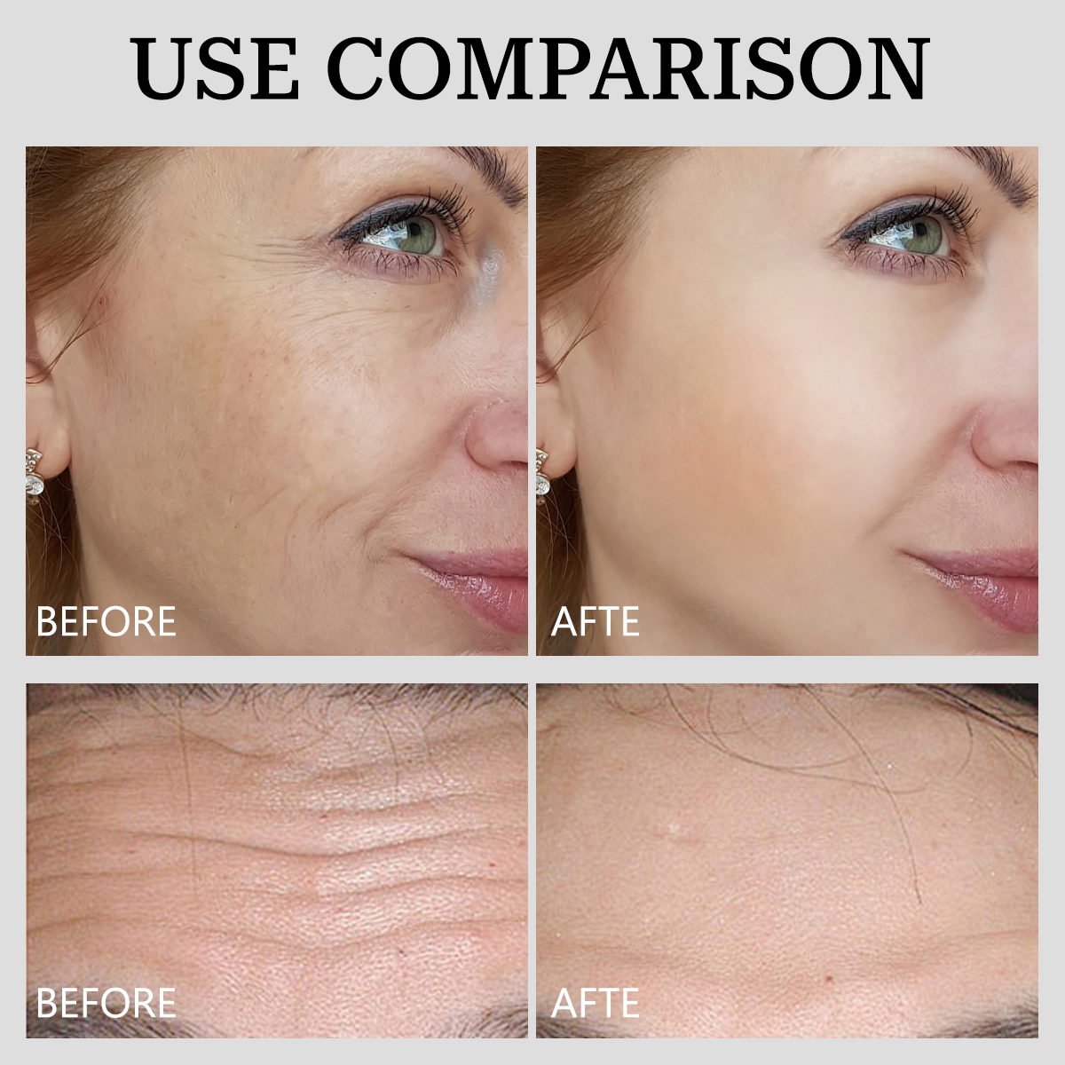 Waterfully Retinol Face Set | Lightening Spots, Smoothing Wrinkles - Image 7