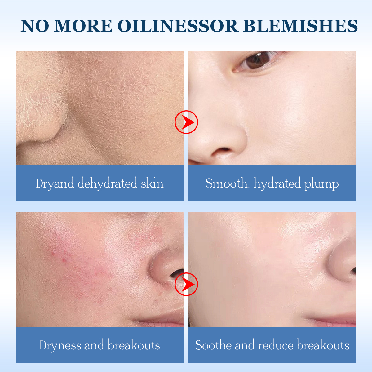 Soothing Facial Spray Set | Hydration · Barrier Repair · Redness Relief - Image 2