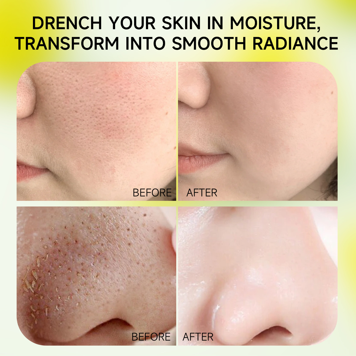 Green Tomato Skincare Set | Pore Tightening · Oil Control · Hydration - Image 3