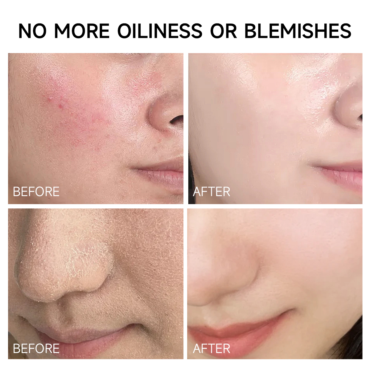 Salicylic Acid Skincare Set | Oil Control · Pore Minimizing · Hydration - Image 2